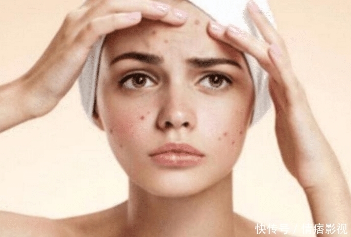 分钟|李佳琦5分钟卖空20000支的洗面奶有多好用?网友:7次闭口消除了