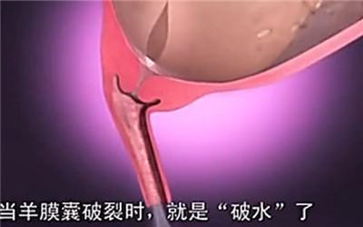 胎头那么大,到底是怎样从那么小的口出来顺产分娩全过程-附图