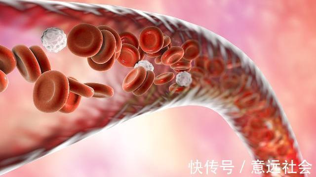 脑供血不足|脑供血不足的人,多吃3种食物,软化血管,更有益于身体健康