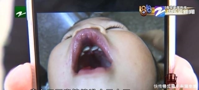 晓菁|女孩从蹦床上摔下来,牙齿磕变形还嵌入肉里,到底谁该负责