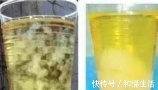 要领|准妈妈生男生女一看便知,再也不用去医院找医生鉴别了!