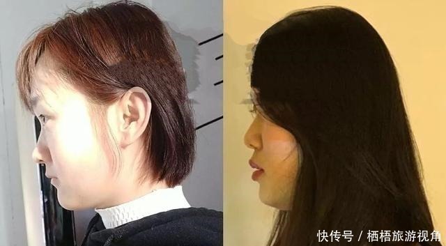 预防颈椎病|“睡枕头”和“不睡枕头”的孩子,长大后到底差别在哪里