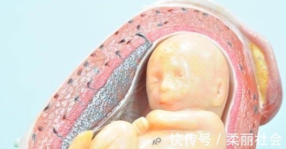 四维彩超|四维彩超单上4个数据,暗示了胎儿秘密,你知道了吗?