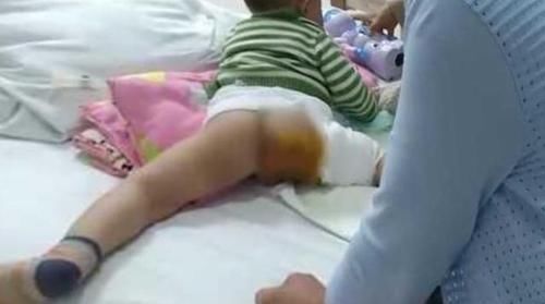孩子|奶奶嫌天热给孙子穿开裆裤,却把娃坑进了医院,医生不怕断后吗