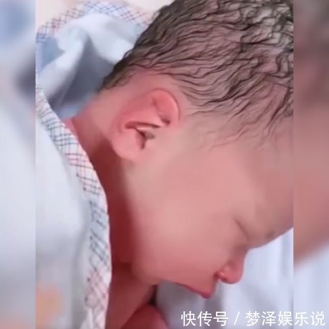 头骨|产妇分娩时不懂正确用力,婴儿头部被严重挤压,网友:很像寿星公