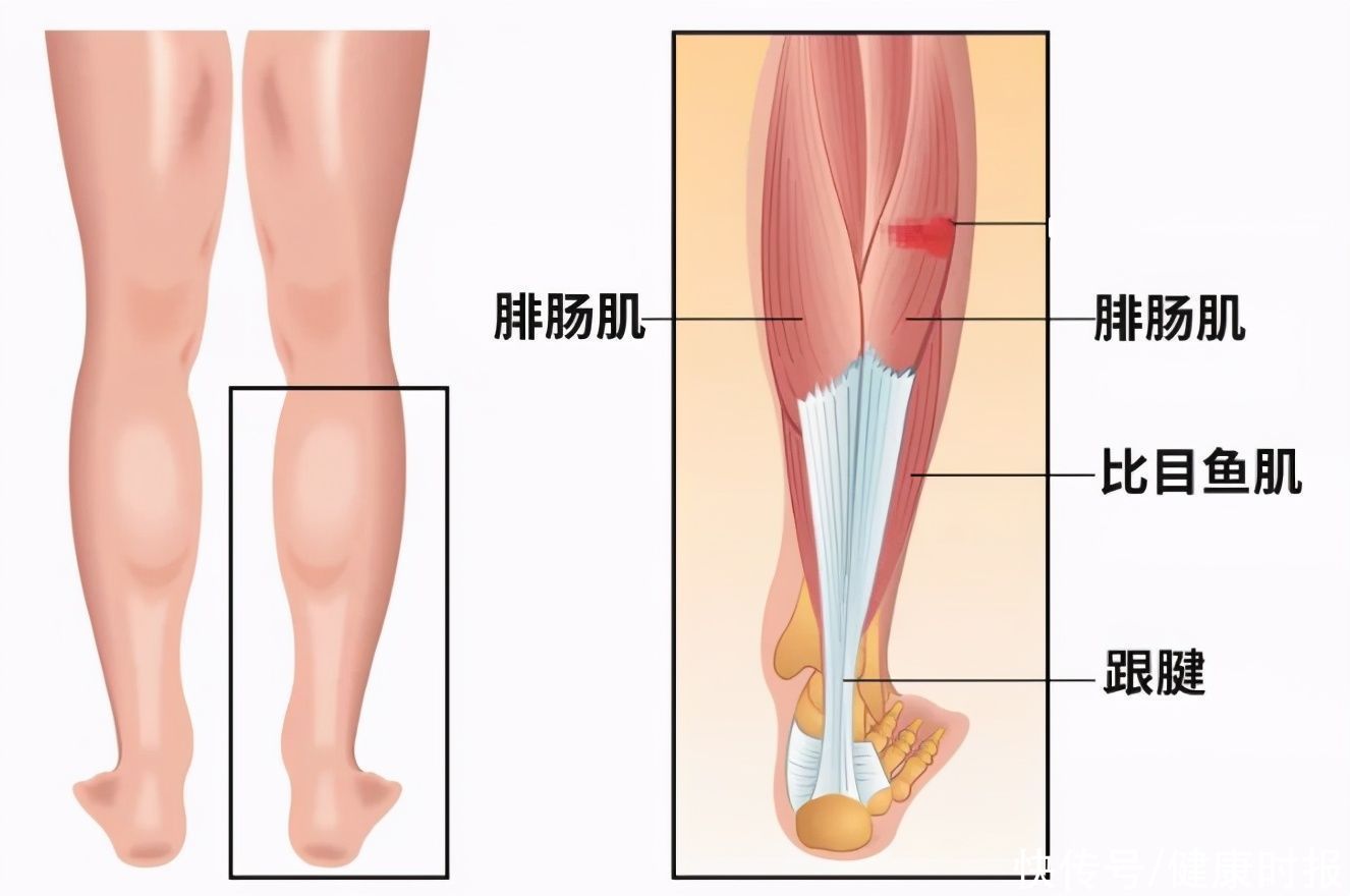 阻断术|“小腿肌肉阻断术”冲上热搜，专家：该方法已经淘汰，切断神经不可修复