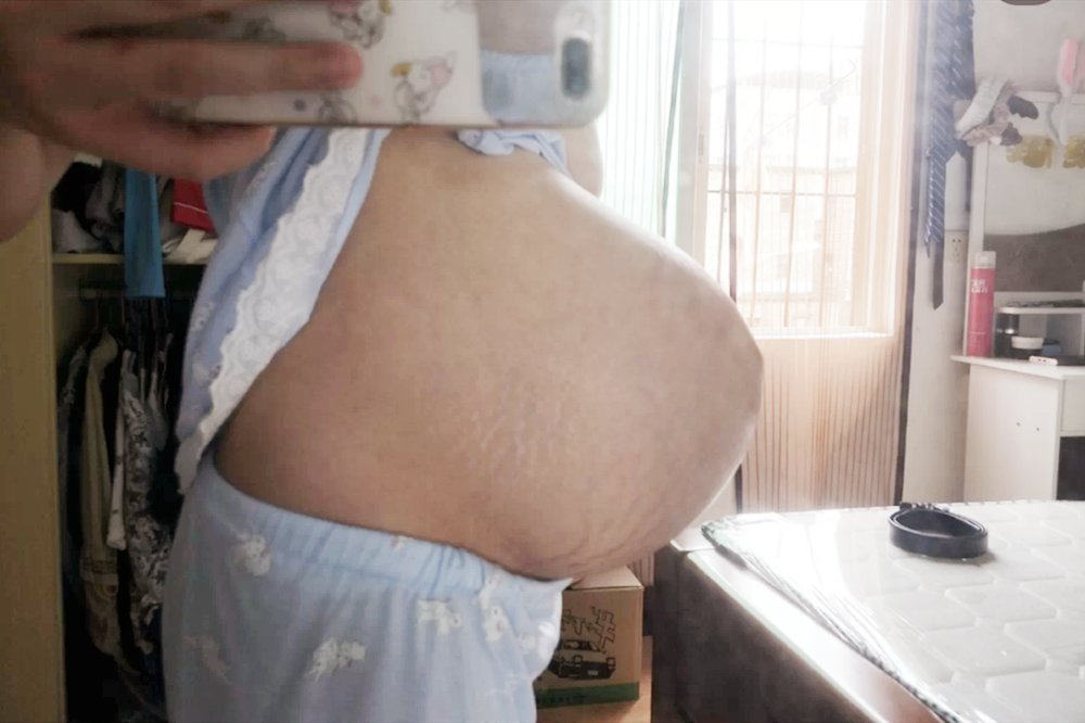 孕肚|“悬浮肚”多十产九剖,想要顺产过关有讲究,孕妈最好别强求