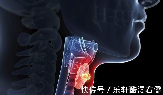 睡眠时间|体内有结节的人,建议这4种食物尽量少碰,不妨了解一下