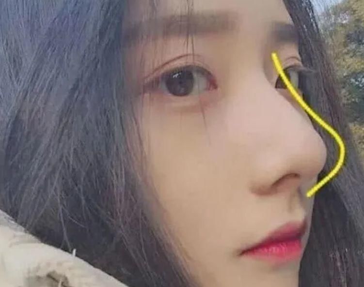 鼻子|经常捏鼻子可以挽救塌鼻梁吗?学会这3招,或能拥有“水滴鼻”!