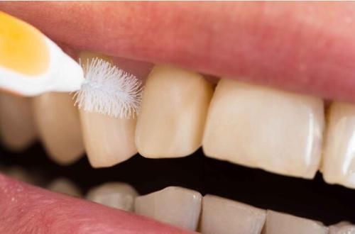 绝经|女性到了45岁，若上半身发生4种变化，很遗憾，衰老正在加速！