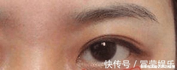 豆制品|女人患有妇科病,脸部会出现这3个暗号,发现1个就最好去查一查