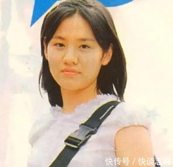 鼻尖抬高,鼻翼惊现疤痕,号称天然美女代名词的她,也翻车了?