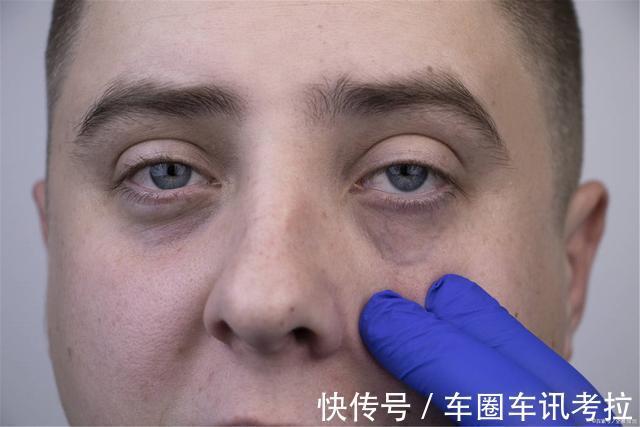 眼袋|健脾“好帮手”已发觉，不是粳米，坚持吃，调和脾胃，脾胃更舒坦