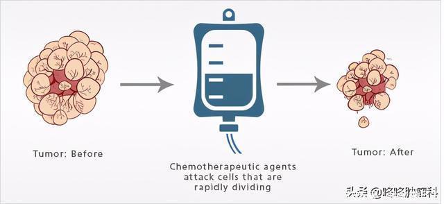 化疗猛如虎，真的吗