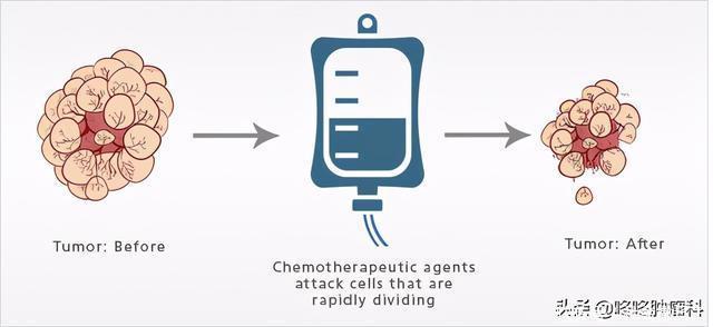 化疗猛如虎,真的吗