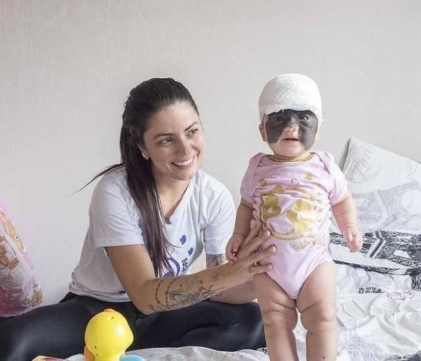 产科医生|胎记是怎么回事产科医生孕期尽量避开3种行为,以免胎儿自卑