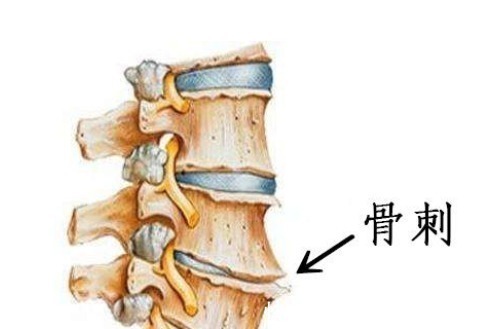 良性|结节、息肉、囊肿、增生哪个最可能癌变这么多年疑惑终于解开了