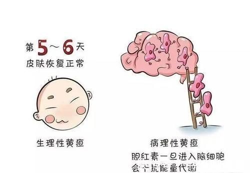 宝妈|宝宝有点黄，到底要不要紧？新手父母不用慌