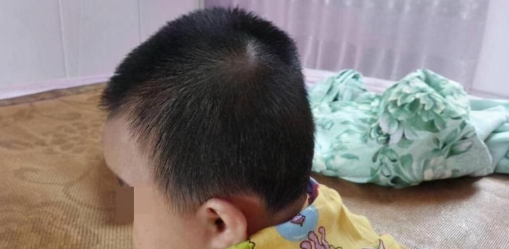 孩子|头型也能预测孩子的身高?拥有这类头型的娃,多半都是高个子