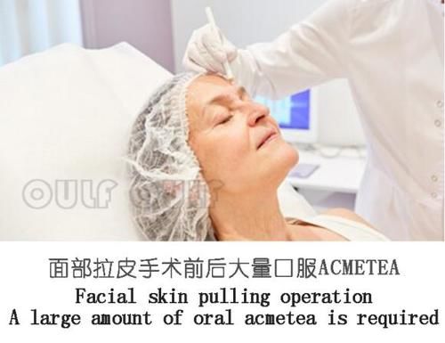 每日一问中面部拉皮手术你做了吗？居然还有人不知道啥是中面部拉皮手术？