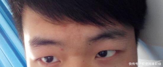 求救|身上4处发黑,说明肝脏在“求救”,多吃补肝水果,预防肝病