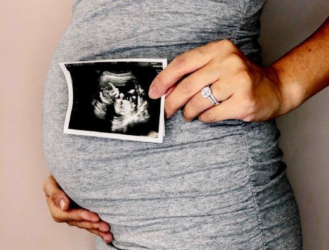 攻略|怀孕多久做B超检查比较好?这份孕早期检查攻略,孕妈们查收学习