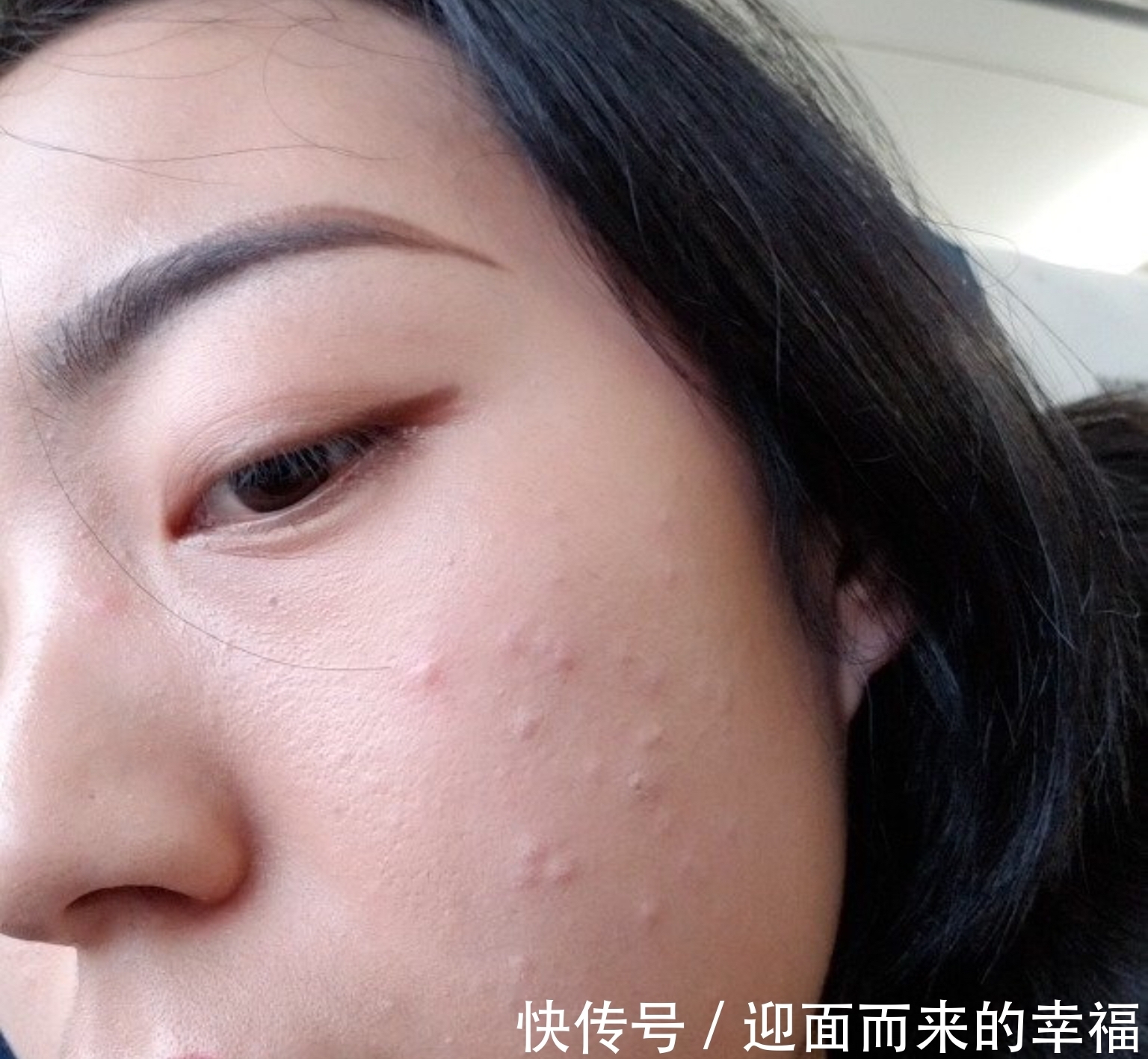 皮肤 护肤“谣言”的13个坑,你是不是全中?