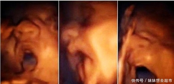 偷看|医生检查进行到一半时，大笑起来，孕妇偷看了一眼，乐了