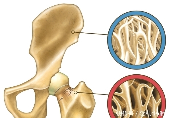 人体|5种身体问题，通过力量训练可明显改善，特别是中老年人需重视
