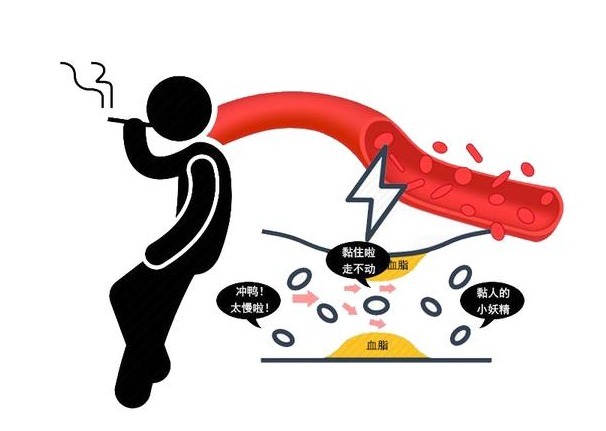 高血压|医生:这4个坏习惯正在偷走你的健康,为高血压打下基础,需改正