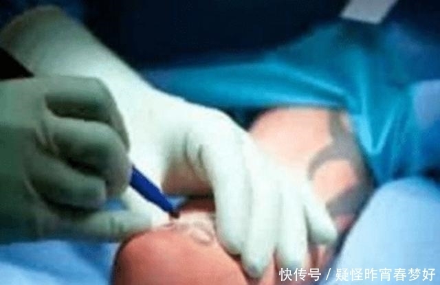 无四肢无嘴唇男子走红,接受手术后成这般,眼神让人心碎!