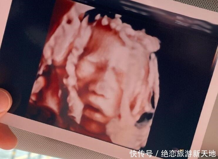 翻盘|四维彩超以为是女儿,生产时成功翻盘,孕期这些症状可能生儿子!