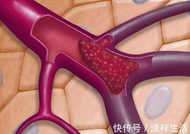 走路锻炼|每天走路锻炼，一段时间后，身体的4个毛病可能会远离你