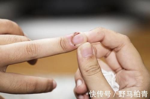 行为|孩子喜欢咬指甲,别认为是小事!这3个原因家长需了解,不要忽视