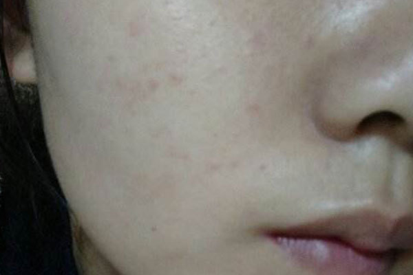 内分泌|子宫“堆满垃圾”的女人，脸上多有这些“痕迹”，外人一眼能看出