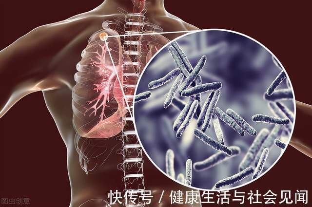 恶性肿瘤|癌症发病率为什么呈年轻化趋势？于加军：这5个行为，少碰才好