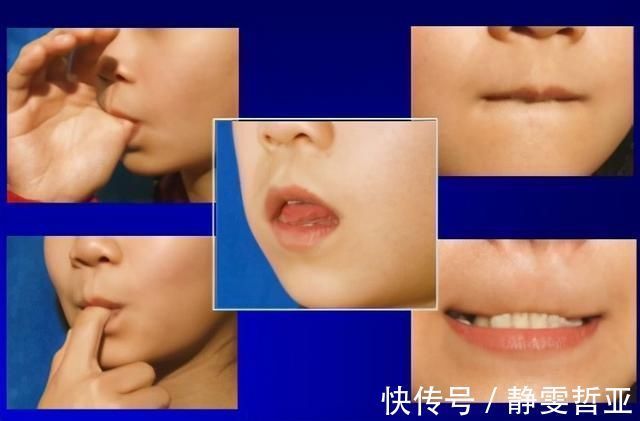 孩子|孩子牙齿长得歪，医生问：他是不是经常做鬼脸吐舌头？