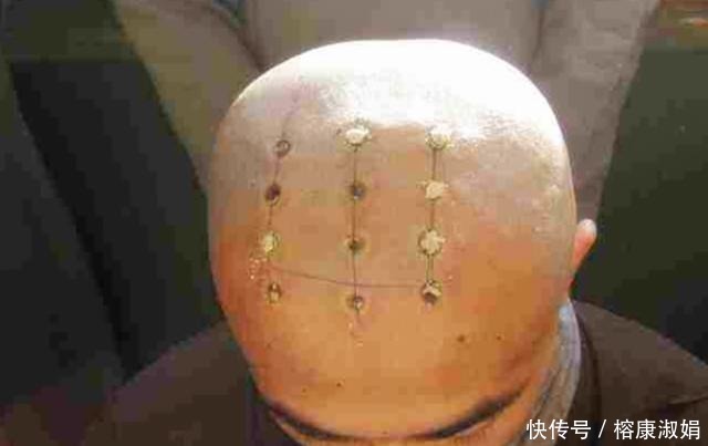 和尚从什么时候开始烧“戒疤”?电视剧中的和尚骗了观众很多年