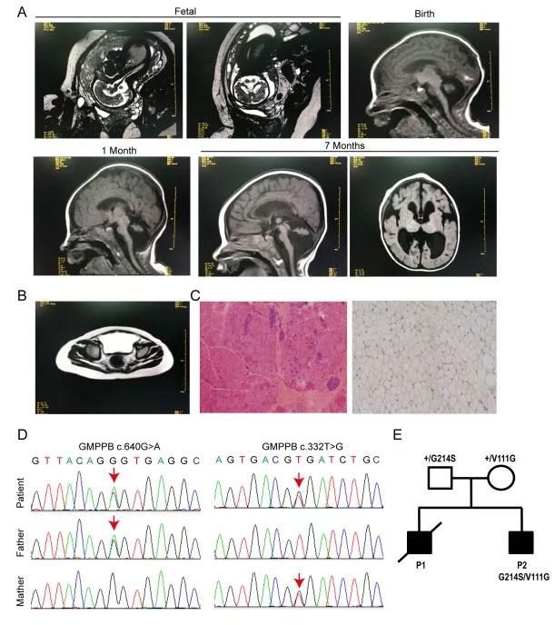 指南 四川大学近期科研成果扫描：重大科学发现、糖尿病国际临床实践指南、5G+XR……
