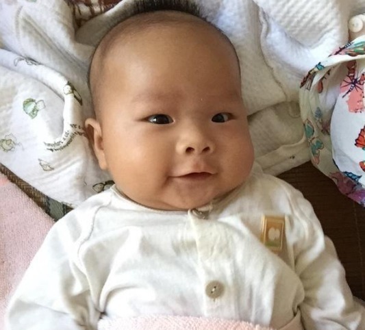 宝宝|如果宝宝脸上有这3种现象,说明宝宝脾胃有问题,别不在意