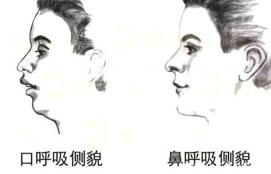 家长|小孩需要有正确的饮食习惯