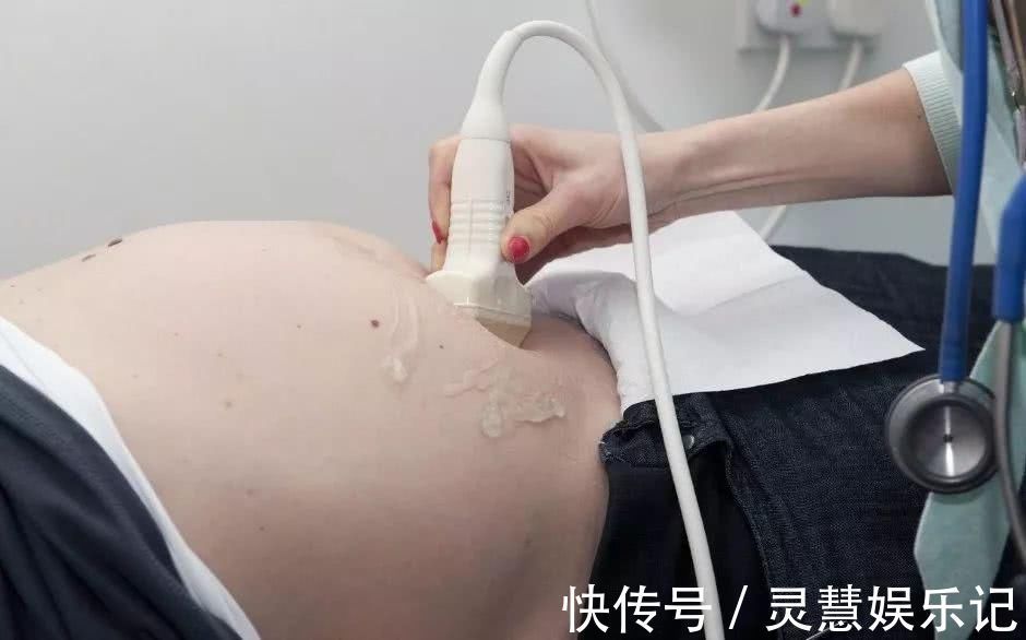 胎位|十月怀胎,这个周是胎儿脐带绕颈“高发期”,孕妇要早知道早预防