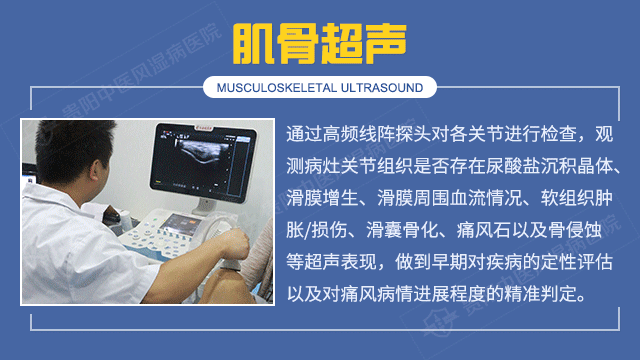 患者|类风湿精准检查,让患者少走弯路!