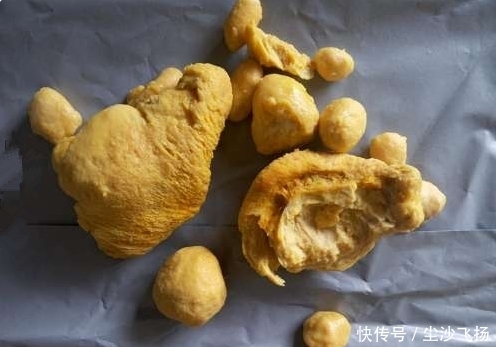 雷姓村民在瘦弱家禽体内掏出异物,意外收获250万