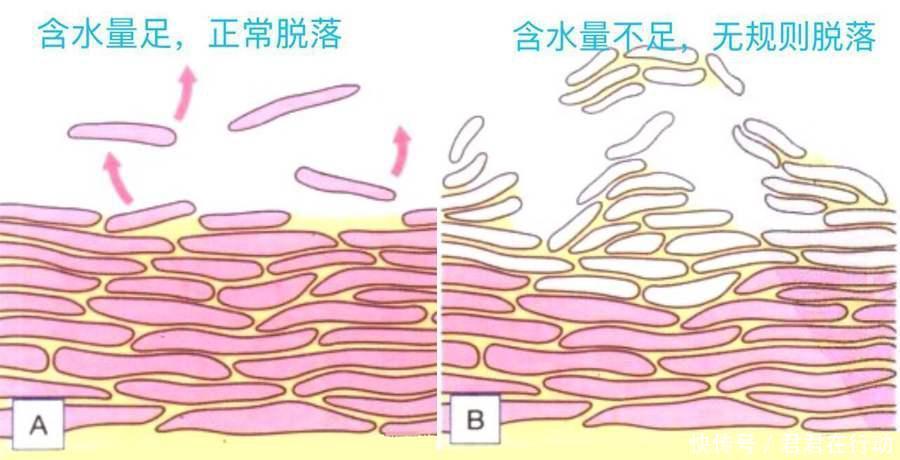 护肤品越用越多,肌肤状态急剧下滑,护肤品真的有效