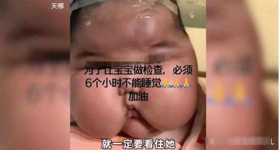 无激素|10万销量的宝宝霜检出强效激素,宝宝的吃穿用如何保障安全?