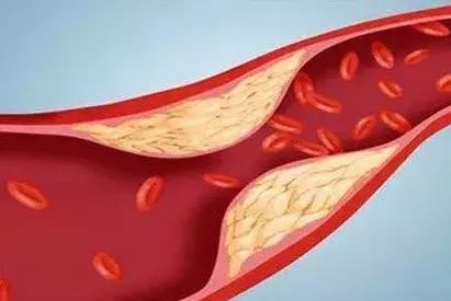 长时间|腿脚抽筋可不是缺钙那么简单，还可能跟这几个因素有关！