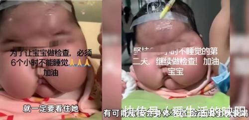 婴儿霜|大头宝宝卷土重来,背后的真相令人发指:生而为人,我劝你善良