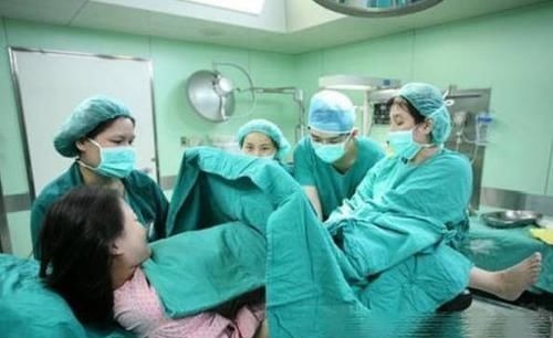 剖腹产|很多女明星为何选剖腹产留下疤痕,也不愿顺产?大夫说出了内情