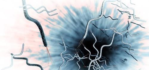 口臭|一家五口口臭,是幽门螺杆菌害的,医生1招杀菌,除口臭养好胃